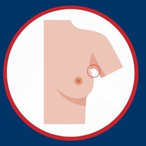 Swelling​ Problem