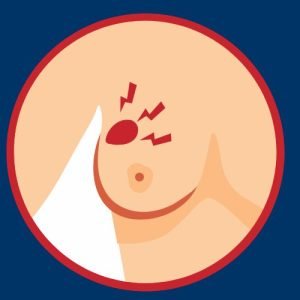 A new Lump​ May feel Hard