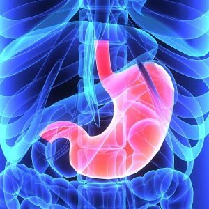 Minimally Invasive Esophagectomy (MIE)