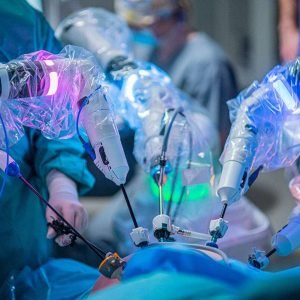 Robotic Esophagectomy