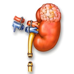 Robotic Partial Nephrectomy