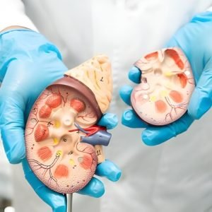 Robotic Complex Kidney Procedures