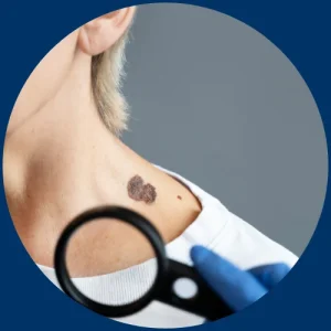 New or Growing Lump​